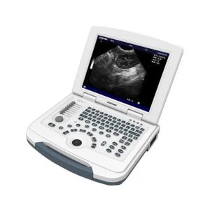 Portable ultrasound scanner MU10